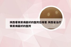 陕西看银屑病最好的医院在哪里 陕西省治疗银屑病最好的医院