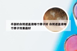 手部的白斑遮盖液哪个牌子好 白斑遮盖液哪个牌子效果最好