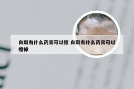 白斑有什么药膏可以擦 白斑有什么药膏可以擦掉