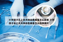 十岁孩子头上长大块白色癣是怎么回事 十岁孩子头上长大块白色癣是怎么回事图片