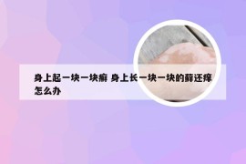 身上起一块一块癣 身上长一块一块的藓还痒怎么办