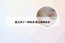 脸上长了一块白点 脸上有块白点