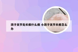 孩子关节处长癣什么病 小孩子关节长癣怎么办