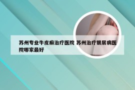 苏州专业牛皮癣治疗医院 苏州治疗银屑病医院哪家最好