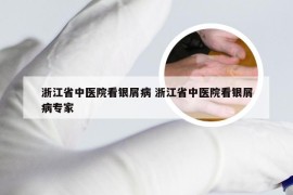 浙江省中医院看银屑病 浙江省中医院看银屑病专家