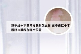 遂宁红十字医院皮肤科怎么样 遂宁市红十字医院皮肤科在哪个位置