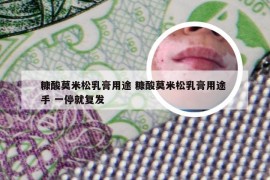 糠酸莫米松乳膏用途 糠酸莫米松乳膏用途 手 一停就复发