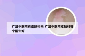 广汉中医院有皮肤科吗 广汉中医院皮肤科哪个医生好