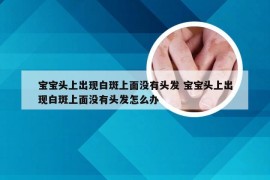 宝宝头上出现白斑上面没有头发 宝宝头上出现白斑上面没有头发怎么办