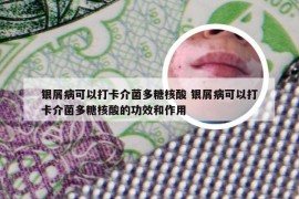 银屑病可以打卡介菌多糖核酸 银屑病可以打卡介菌多糖核酸的功效和作用