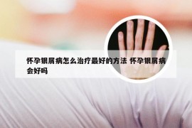 怀孕银屑病怎么治疗最好的方法 怀孕银屑病会好吗