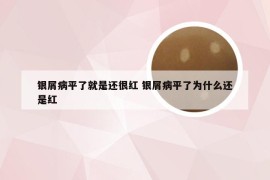 银屑病平了就是还很红 银屑病平了为什么还是红