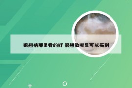 银翘病那里看的好 银翘散哪里可以买到