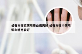 长春市哪家医院看白癜风好 长春市哪个医院调血糖比较好