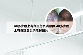 40多岁脸上有白斑怎么消除掉 40多岁脸上有白斑怎么消除掉图片