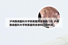 泸州西南医科大学附属医院皮肤科门诊 泸州西南医科大学附属医院皮肤科门诊时间