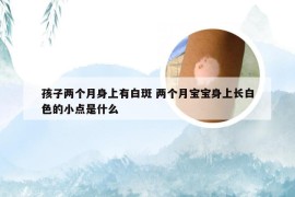 孩子两个月身上有白斑 两个月宝宝身上长白色的小点是什么