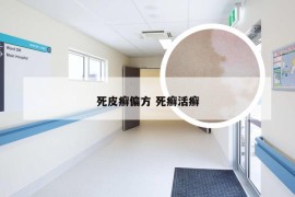 死皮癣偏方 死癣活癣