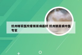 杭州哪家医院看银屑病最好 杭州银屑病中医专家