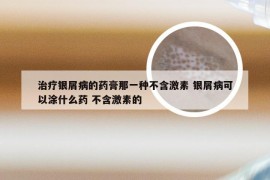 治疗银屑病的药膏那一种不含激素 银屑病可以涂什么药 不含激素的