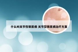 什么叫关节性银屑病 关节型银屑病治疗方案