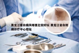 黑龙江看白癜风哪里比较好玩 黑龙江省白斑病诊疗中心地址