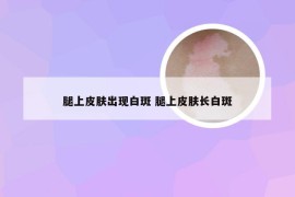 腿上皮肤出现白斑 腿上皮肤长白斑