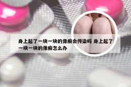 身上起了一块一块的像癣会传染吗 身上起了一块一块的像癣怎么办