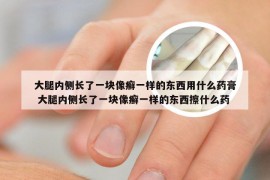 大腿内侧长了一块像癣一样的东西用什么药膏 大腿内侧长了一块像癣一样的东西擦什么药