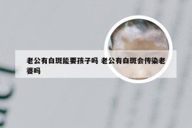 老公有白斑能要孩子吗 老公有白斑会传染老婆吗