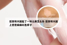 后背和大腿起了一块儿癣怎么办 后背和大腿上密密麻麻红色疹子