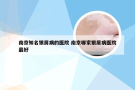 南京知名银屑病的医院 南京哪家银屑病医院最好