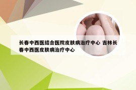 长春中西医结合医院皮肤病治疗中心 吉林长春中西医皮肤病治疗中心