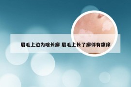 眉毛上边为啥长癣 眉毛上长了癣伴有瘙痒