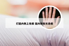 打腿内侧上有癣 腿内侧有长条癣