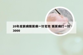 20年皮肤病银屑病一针见效 银屑病打一针3000