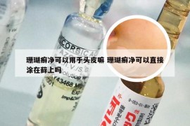 珊瑚癣净可以用于头皮嘛 珊瑚癣净可以直接涂在藓上吗