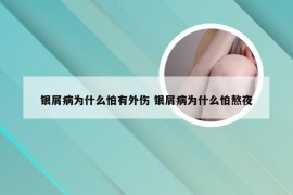 银屑病为什么怕有外伤 银屑病为什么怕熬夜