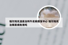 福尔阳光温泉浴所牛皮癣康复中心 福尔阳光治银屑病有用吗