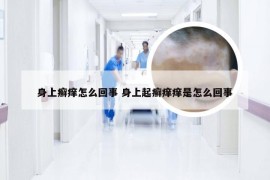 身上癣痒怎么回事 身上起癣痒痒是怎么回事