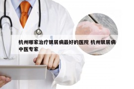 杭州哪家治疗银屑病最好的医院 杭州银屑病中医专家