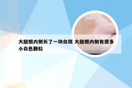 大腿根内侧长了一块白斑 大腿根内侧有很多小白色颗粒