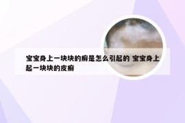 宝宝身上一块块的癣是怎么引起的 宝宝身上起一块块的皮癣