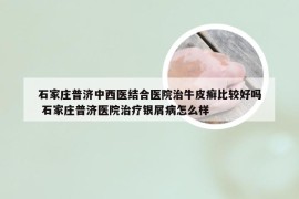 石家庄普济中西医结合医院治牛皮癣比较好吗 石家庄普济医院治疗银屑病怎么样