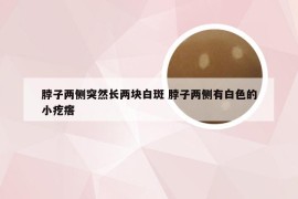 脖子两侧突然长两块白斑 脖子两侧有白色的小疙瘩