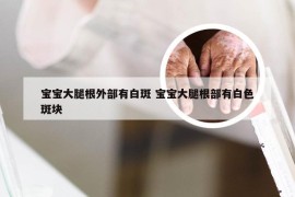 宝宝大腿根外部有白斑 宝宝大腿根部有白色斑块