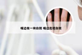 嘴边有一块白斑 嘴边出现白斑