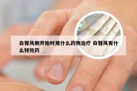 白臀风刚开始时用什么药物治疗 白臀风有什么特效药