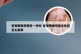 宝宝眼睛周围有一块白 宝宝眼睛周围白色的怎么回事