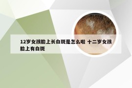 12岁女孩脸上长白斑是怎么啦 十二岁女孩脸上有白斑